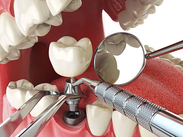 Best Emergency Broken Tooth Repair in Robbinsdale, MN